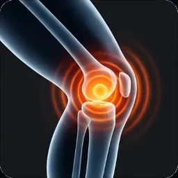 Rodilla